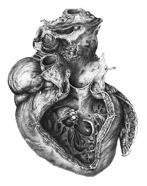 Medical Illustration | Kendall College of Art and Design of Ferris State University Medical Illustration Design, Anatomical Heart Art, Medical Drawings, Male Figure Drawing, The Human Heart, Human Anatomy Drawing, Human Figure Drawing, Human Anatomy Art, Medical Art