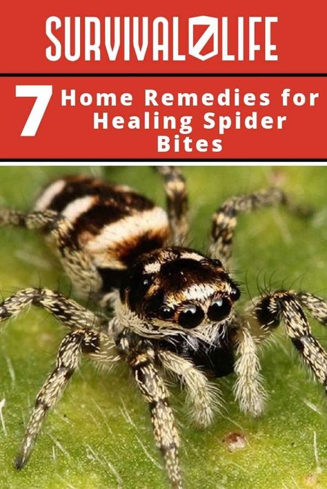 🕷🕸⛑ The symptoms of spider bites may be visible as soon as possible, to several days or even weeks. 😲 You will want to avoid getting bitten by a spider at all costs since it may spell doom if it’s the deadlier kind. 👍🏼 Thus, here are 7 tips on how to treat spider bites at home. #spider #spiderbites #outdoorskills #outdoors #bushcraft #survivaltips #survivalskills #survivalkit Treating Spider Bites, Spider Bite Symptoms, Spider Repellant, Brown Recluse Spider Bite, Hobo Spider, Home Remedies For Spiders, Homemade Lotions, Spider Bite, Brown Recluse Spider