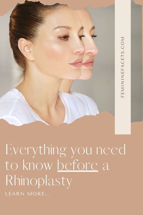 Rhinoplasty recovery tips, nose job timeline & what to know before getting a nose job (rhinoplasty) ♥ Before and After nose job | Rhinoplasty recovery tips| Nose job recovery Rhinoplasty Recovery Tips, Nose Job Before And After Rhinoplasty, Nose Jobs Before And After, Rhinoplasty Before After, Rhinoplasty Recovery Timeline, Nose Job Before And After, Nose Job Recovery, Before And After Nose Job, Biggest Insecurities