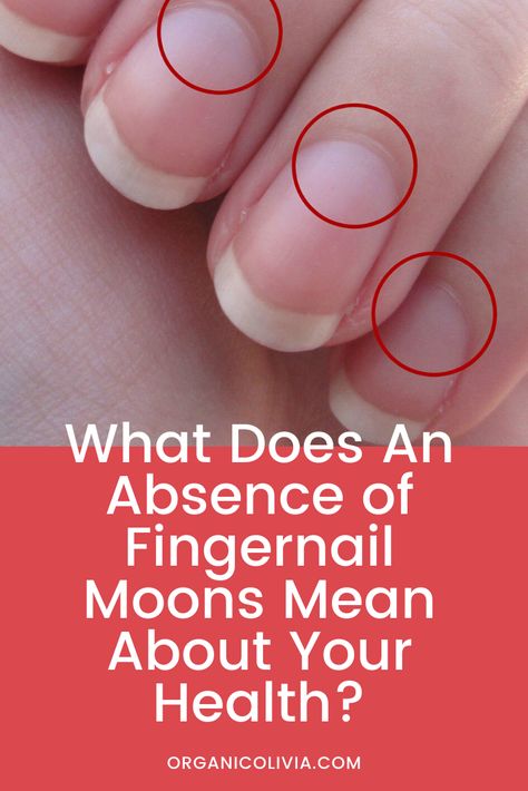 Nail Health Signs, Fingernail Health, Moon Meaning, Health Signs, Tongue Health, Natural Health Tips, Thyroid Health, Nail Health, Sore Throat