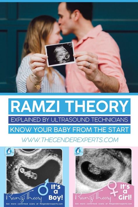 Baby Heart Rate Gender Prediction, Sonogram Gender Prediction, Baby Heartbeat Gender Prediction, Ramsey Theory Baby Gender, 6weeks Pregnant Ultrasound, Week 6 Of Pregnancy, 8weeks Pregnant Ultrasound, Anterior Placenta Gender Prediction, Fetal Heart Rate Gender