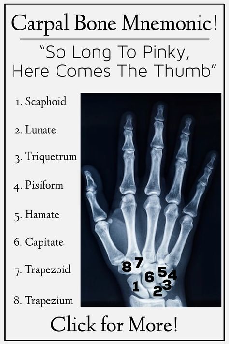 Bone Memorization, Hand Xray Anatomy, Bones Of The Hand And Wrist, Anatomy Easy Learning, Anatomy And Physiology Mnemonics, Bones Names Anatomy, Wrist And Hand Anatomy, Carpal Bones Anatomy, Carpal Bones Mnemonic