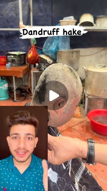 sachin raghav on Instagram: "Dandruff ka solution" Hair Dandruff Solution, Dandruff Solutions, Hair Dandruff, Shaved Head, Care Hair, Dandruff, Home Remedies, Shaving, Hair Care