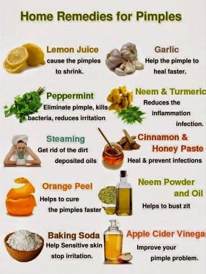 Home remedies for pimples. Bumps On Face, Small Bumps On Face, Remedies For Pimples, Severe Acne Remedies, Natural Remedies For Sunburn, Home Remedies For Pimples, Sunburn Remedies, Remedies For Acne, Skin Natural Remedies