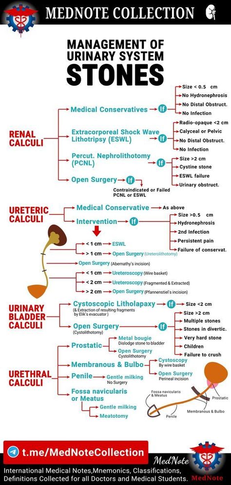 Management of Urinary Stones medicalschool #resources #medicalstudent - Image Credits: MedNote Collection Medical Terminology Study, Medical Ultrasound, Medical Mnemonics, Medical Notes, Medicine Notes, Basic Anatomy And Physiology, Nursing Mnemonics, Nursing Student Tips, Medical Student Study