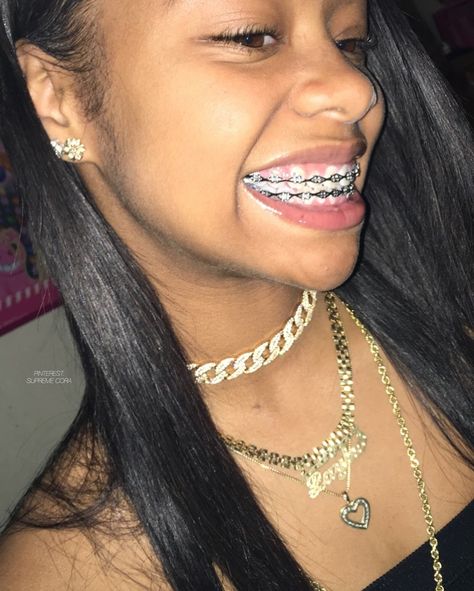 #braceface Silver Braces Black Women, Black Braces Power Chain, Braces Power Chain Aesthetic, Girls With Braces Black, Braces Aesthetic Girl Black, Black Braces, Cute Girls With Braces, Cute Braces Colors, Clear Braces