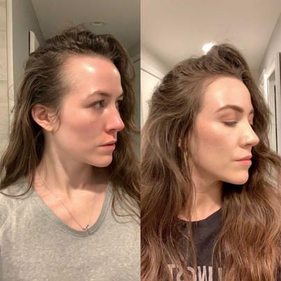 Topdust - I Tried Vegamour And Nutrafol For My Thinning... | Facebook Nutrafol Before And After, Blue Light Therapy, Fuller Hair, Hair Solutions, Long Locks, Nail Color, Light Therapy, 4 In 1, Hair Products