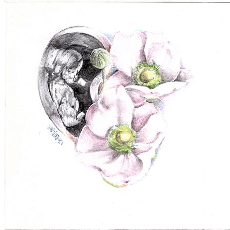 https://flic.kr/p/FJEaDS | baby ultrasound tattoo sketch japanese anemone by Kirillnbb Ultrasound Tattoo, Sonographer Tattoo, Ultrasound Tattoo Ideas, Ultrasound Wallpaper, Ultrasound Logo Design, Ultrasound Art, Ultrasound Art Paintings, Pink Floyd Wallpaper Iphone, Vintage Clock Tattoos