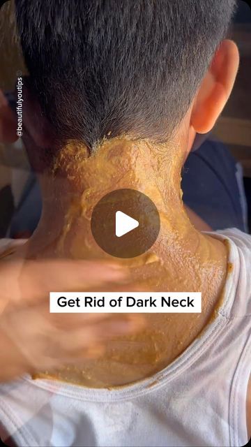 How To Get Rid Of Dark Neck, Dark Skin Around Neck, Dark Neck Remedies, Tan Removal Home Remedies, Dark Patches On Skin, Skin Lightening Diy, Dark Neck, Homemade Face Pack, Face Care Tips