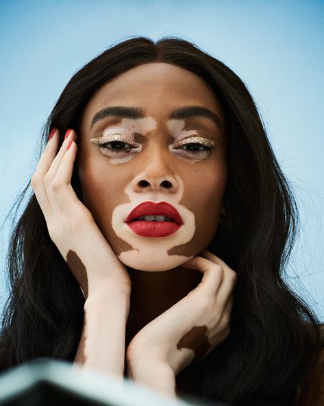 Winnie Harlow in Grazia UK June 25th, 2018 by Jason Hetherington Face Drawing Reference, Winnie Harlow, Human Reference, Face Reference, Face Photography, Arte Inspo, Art Style Inspiration, Portrait Inspiration, Photo Reference