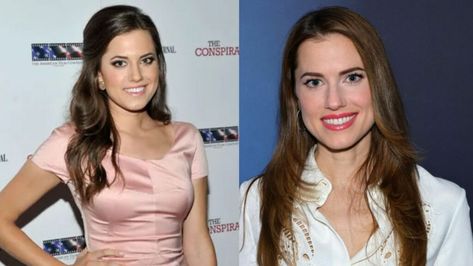 Allison Williams has not gotten a nose job. She sure has a very narrow, sharp, and refined nose but it looks like she has always had it. She did not have to go under the knife to achieve it. Allison Williams has not denied having cosmetic work to change her nose but she has not confirmed it either. Allison Williams, Under The Knife, Nose Job, Plastic Surgery, Surgery