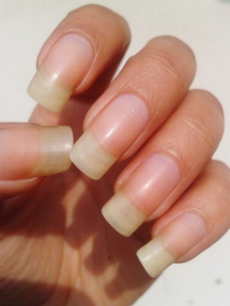 Nail Whitening, Grow Nails Faster, Long Natural Nails, Yellow Nail Art, Yellow Nails Design, Weak Nails, Nail Care Tips, How To Grow Nails, Brittle Nails