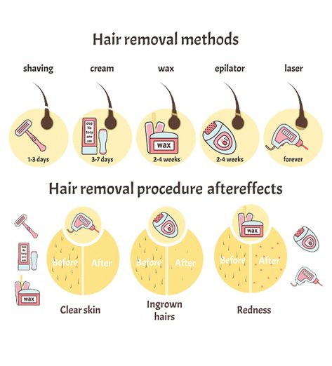 Waxing Business, Wax Tips, Natural Hair Removal Remedies, At Home Laser Hair Removal, Laser Hair Removal Cost, Home Laser Hair Removal, Leg Hair Removal, To Remove Facial Hair, Waxing Tips