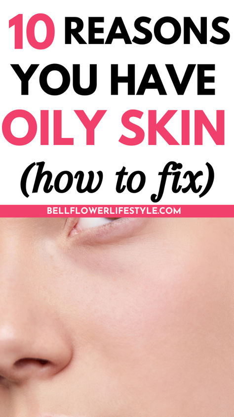 10 reasons you have oily skin ( how to fix ) Why Is My Face So Oily, Oily Skin Face, Oily Skin Remedy, Dry Oily Skin, Acne Prone Skin Care, Lotion For Oily Skin, Tips For Oily Skin, Oily Face, Oily Skin Care Routine