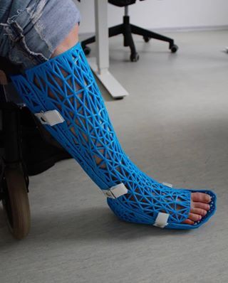 Drukarka 3d, Leg Cast, 3d Printing Industry, Plaster Cast, Leg Braces, 3d Printer Designs, 3d Printing Diy, 3d Printing Service, Medical Design