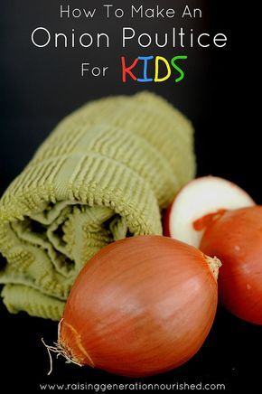 How To Make An Onion Poultice For Kids - Raising Generation Nourished Also works for ear ache by placing poultice behind affected ear. Onion Poultice, Chest Congestion Remedies, Remedies For Chest Congestion, Congestion Remedies, Cold And Cough Remedies, Sick Remedies, Remedies For Cough, Home Remedy For Cough, Cold Sores Remedies