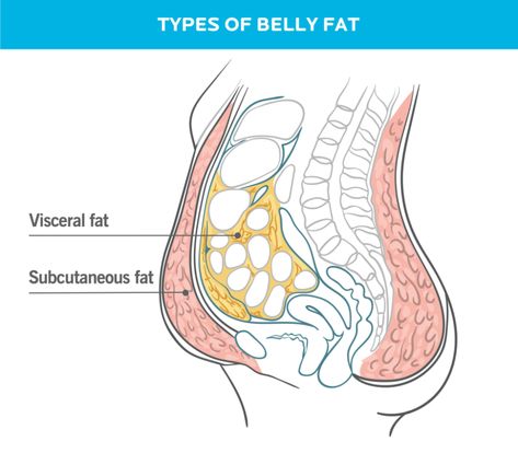 How To Lose Belly Fat, According to Science | Precision Nutrition How To Get Rid Of A Pot Belly, How To Get Rid Of Baby Fat Lose Belly Quick, Lower Belly Pooch, Types Of Belly Fat, Belly Fat Reduction, Precision Nutrition, Pot Belly, Flatter Stomach, Baby Fat