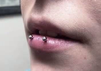 Horizontal labret Horizontal Labret Piercing, Horizontal Lip Piercing, Dolphin Bites Piercing, Vertical Labret Piercing Aesthetic, Dolphin Bites, Different Lip Piercings, Goth Unicorn, Lip Piercing Labret, Vertical Labret Piercing