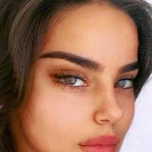 Cat eye look with a temple lift or a lateral canthoplasty? (photos) Cat Eye Surgery Before And After, Cat Eye Surgery, Eye Lift Surgery, Cat Eye Look, Facial Surgery, Medical Consultation, Facial Plastic, Eye Surgery, Eye Lift