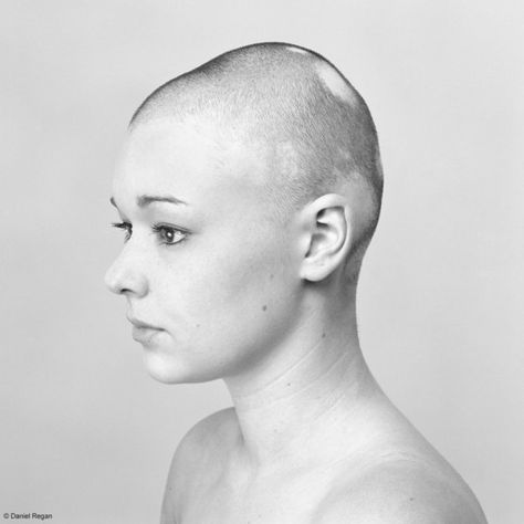 The Alopecia Project is a photography series by Daniel Regan that features women, men and children with alopecia. Alopecia Photography, Bald People, Hair Tattoo Designs, Bald Beauty, Ladies Wigs, Head Painting, Alopecia Hairstyles, Powerful Photos, Hair Science