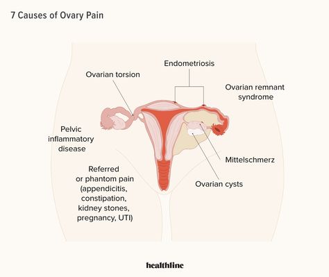 Ovary Pain: 7 Potential Causes, Symptoms, and Treatments Ovary Pain, Phonics Rules, Icd 10, Healthy Morning Routine, Pelvic Pain, Red Bottom, Endocrine System, Toning Workouts, Chronic Illness