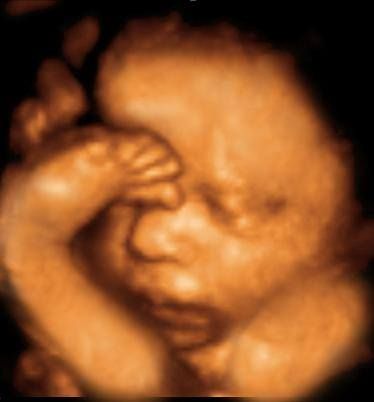 Do you know who's performing your 3D/4D Ultrasounds? Luckily, our clients do! All of our sonographers are ARDMS certified, which means they have the same certification of the nurses in your doctor's offices. 4d Ultrasound Pictures, 3d Ultrasound Pictures, Pregnancy Spa, Baby Ultrasound Pictures, Gender Determination, 3d Ultrasound, 4d Ultrasound, Urgent Care Clinic, Maria Victoria