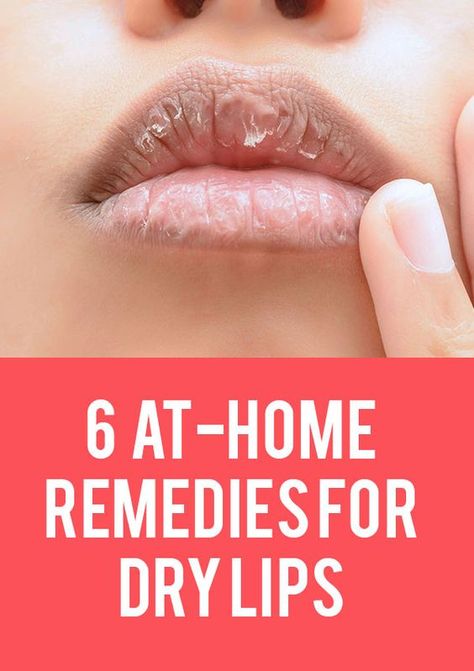 "My lips feel rough and dry and I’m so over it. I’ve been trying lip scrubs and all different kinds of lip balm, but nothing seems to be truly solving my problem. In case you’re in the same boat as me, here are six at-home remedies to soothe your dry lips." Remedies For Dry Lips, Lips Remedies, Dry Lips Remedy, Dry Cracked Lips, Cracked Lips, Lip Beauty, Zero Calories, Skin Remedies, Chapped Lips