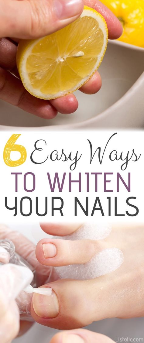 How to whiten your nails from home with these 6 DIY tricks! Baking soda, lemon, hydrogen peroxide, toothpaste.... chances are you probably already have most of these ingredients. Nail Whitening, Paznokcie Hello Kitty, Diy Pedicure, Baking Soda And Lemon, Pedicure Colors, Pedicure At Home, Pedicure Designs, Baking Soda Shampoo, Diy Baking