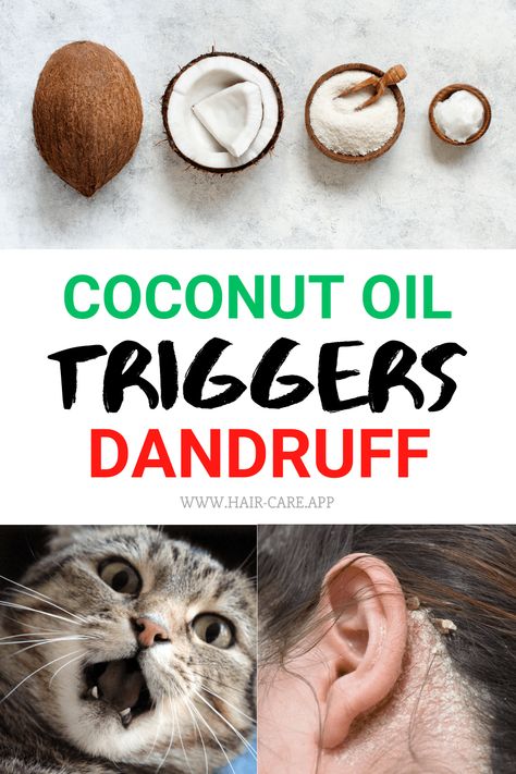 Do you still believe that coconut oil is the most powerful natural remedy for your hair and scalp? You might be wrong! Coconut oil is not for all hair types. Moreover, it can trigger dandruff... Click on the pin to learn more #hair #haircare #hairproducts Diy Hair Mask For Dandruff, Coconut Oil For Dandruff, Hair Mask For Dandruff, Diy Hair Oil, Whipped Coconut Oil, Oils For Dandruff, Grow Long Healthy Hair, Liquid Coconut Oil, Apply Coconut Oil