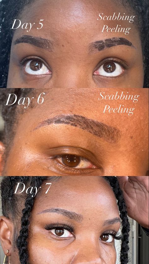 Ombre powder brows on black women. Ombre powder brows healing PMU Ombre Power Brows, Microblading Black Women, Ombre Brows Healing Process, Brow Lamination Black Women, Powder Brows Healing Process, Ombre Brows Before And After, Ombré Powder Brows, Powder Ombre Eyebrows, Ombre Powder Brows