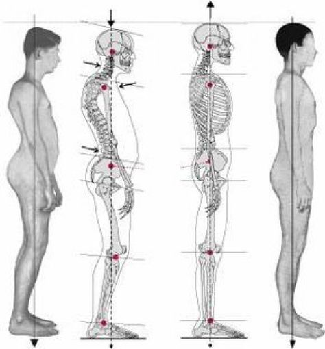 Psoas Iliaque, Structural Integration, Psoas Release, Forward Head Posture, Craniosacral Therapy, Posture Exercises, Muscle Anatomy, Muscles In Your Body, Medical Anatomy