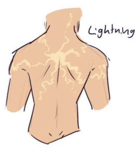 How To Draw Lightning, Lightning Scar, Giant Cat, Hero Academia Characters, Cool Art Drawings, Dnd Characters, Drawing Tips, Magical Girl, Owl House