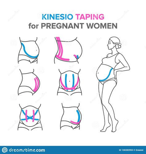 K Tape, Kinesio Taping, Belly Support, Baby Life Hacks, Kinesiology Taping, Pregnancy Health, Foto Baby, Pregnancy Care, Pregnancy Birth