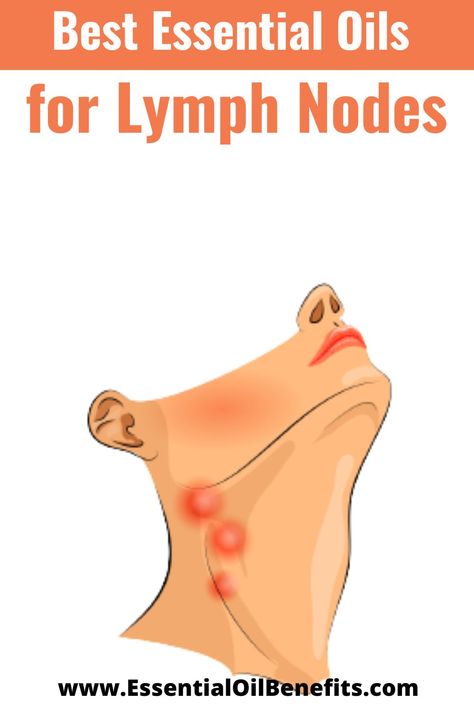 Best Essential Oils For Lymph Nodes Oils For Lymph Nodes, Essential Oils For Lymph Nodes, Essential Oil For Swelling, Lymph Glands, Oils For Sinus, Lymph Fluid, Lymph Drainage, Essential Oil Benefits, Daily Health Tips