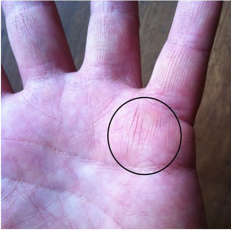 What Does The Lines On Your Hand Mean, Palm Signs Of A Witch, Witch Birthmarks, Healers Mark Palm, Palm Markings, Witch Markings, Healer Witch, Hand Reading, Palmistry Reading