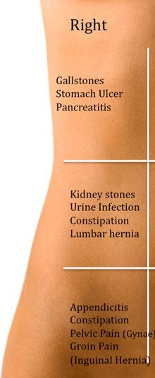 Right, Left and Central Abdominal Pain Stomach Pain Chart, Stomach Pain Relief, Abdominal Pain Relief, Lower Abdominal Pain, Mid Back Pain, Nclex Review, Severe Back Pain, Middle Back Pain, Lower Stomach