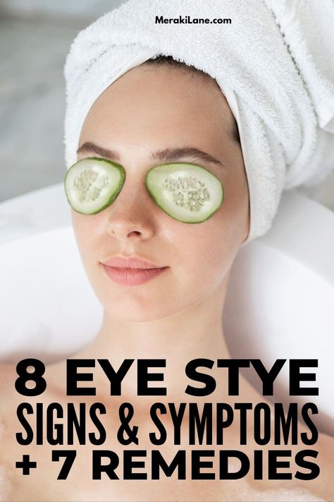 Sty Eye Remedies How To Get Rid, What Causes A Stye In Your Eye, Remedies For Stye On Eyelid, How To Get Rid Of An Eye Infection, Get Rid Of Stye, Natural Remedy For Eye Infection, Stye Remedy, Eye Stye Remedies, Baggy Eyes