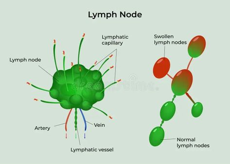 Lymph node System medical illustration royalty free illustration Lymph Node, Beauty Therapy Room, Lymph System, Sciatic Nerve Pain, Sciatic Nerve, Lymph Nodes, Beauty Therapy, Learning Techniques, Therapy Room