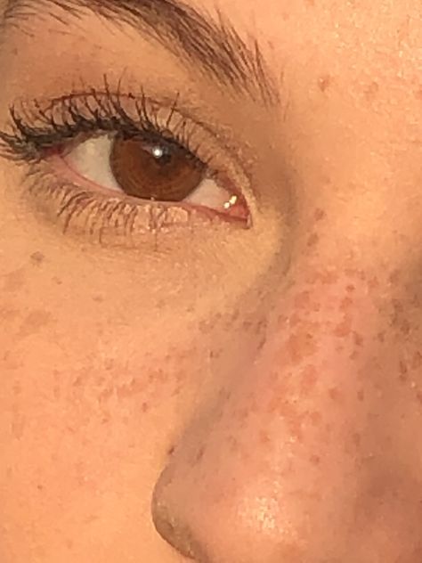 Brown Eyes And Freckles Aesthetic, Light Freckles On Nose Aesthetic, Freckled Skin Aesthetic, Freckles Aesthetic Faceless, Birthmarks For Shifting, Brown Eyes With Freckles, Slight Freckles, Light Brown Eyes Aesthetic, Birthmarks Aesthetic