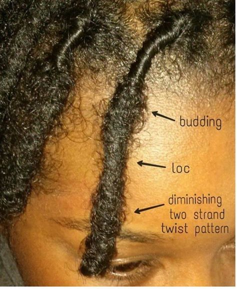 Sorry of my life right now! Wish it would loc already! Starter Locs Tips, Started Locs Styles, Loc Smithing Method, 2 Strand Starter Locs, Stages Of Locs, Loc Budding Stage, Loc Stages, 1 Month Starter Locs, Loc Process