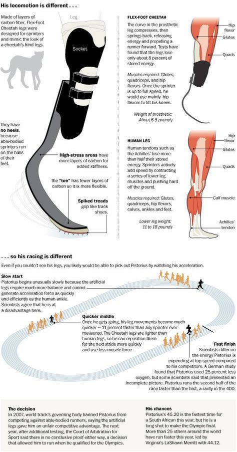 Running Blades Prosthetic, Prosthetic Leg Types, Prothstetics Leg, Prostethics Leg, Leg Prosthesis, Amputee Model, Leg Reference, Orthotics And Prosthetics, Oscar Pistorius