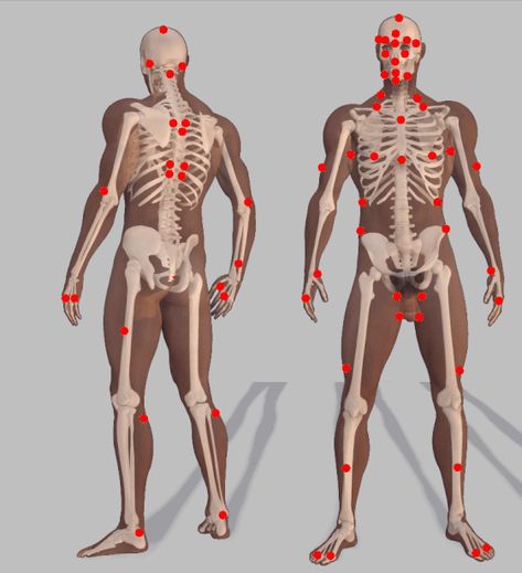 DIM MAK PRESSURE POINT CHART.............. Pressure Point Chart, Pressure Points Chart, Dim Mak, Pressure Point, Pressure Points, Anime, Pins, Quick Saves