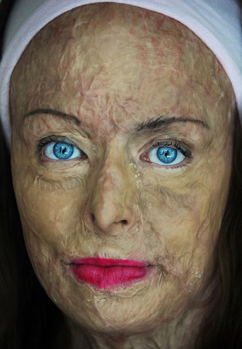 I want to cry and smile and lose my breath all at the same time: "Portrait Of A Burn Survivor" Chemical Burn, Lemon Face Mask, British Journal Of Photography, Lose My Breath, Human Emotions, Interesting Faces, Beauty Queens, Beautiful World, Face And Body