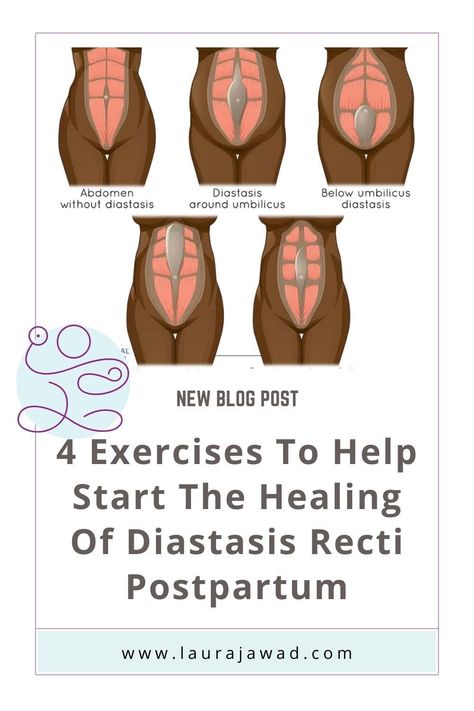 Abdominal Separation Diastasis Recti, Wall Pilates For Diastasis Recti, Diastasis Recti Wall Exercises, Abdominal Exercises After C Section, 8 Weeks Postpartum, Diastasis Recti Exercises In Bed, Repair Diastasis Recti, Fix Diastasis Recti 21 Days, Heal Diastasis Recti Fast