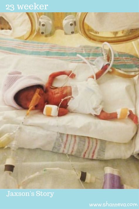 While many hospitals consider 24 weeks viability for babies, some hospitals are saving babies even earlier. Today, meet a 23 weeker that has beat all the odds. Preemie Babies Pictures, Doctor Dream, Neonatal Nursing, Nicu Nursing, Charity Sewing, Premie Baby, Preterm Labor, Premature Birth, Sweet Pictures