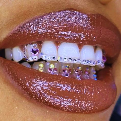 Tooth Jewelry is painless, non-evasive, and requires absolutely no drilling!! Lasts 2-3 years with proper care. Book your Service NOW! Canine Tooth Gem, Tooth Gems Men, Tooth Gem Designs, Teeth Goals, Tooth Gem Placement, Gap Grillz, Teeth Jewels, Tooth Gems Ideas, Teeth Bling