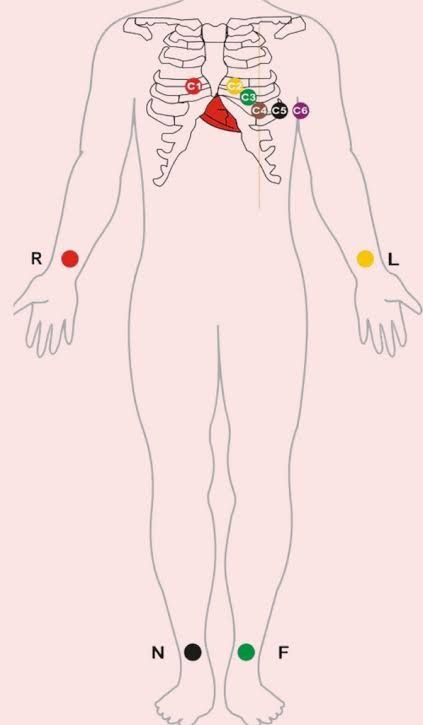 ECG Leads placement Ecg Lead Placement, Echocardiography Study, Ekg Lead Placement, 12 Lead Ekg Placement, Ecg Placement, Ekg Placement, Ekg Leads, Emt Study, Cardiology Nursing