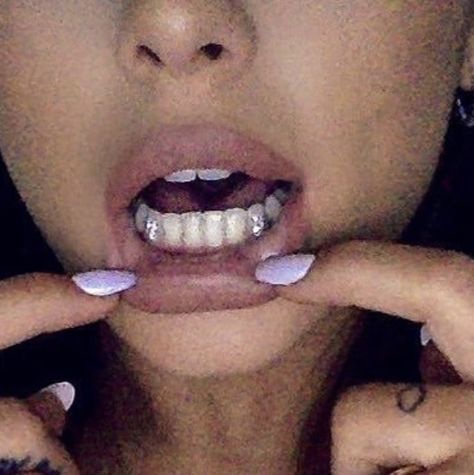 Bottom Tooth Gem, Tooth Gems Bottom Teeth, Tooth Gem Placement, Pretty Teeth, Grillz Teeth, Diamond Teeth, Grills Teeth, Tooth Gem, Teeth Jewelry