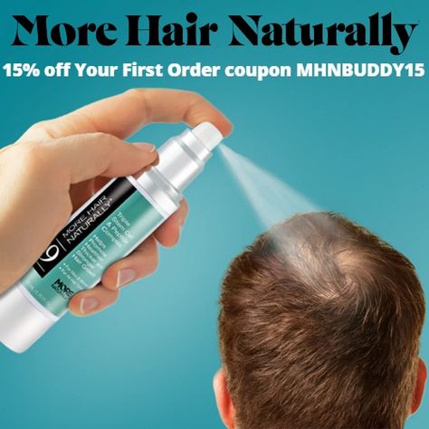 Fix Thinning Hair, Hairstyles To Cover Bald Spots, Bald Spots Women, Bald Spot, Men Hair Color, Moisturizing Conditioner, Hair Vitamins, Dry Scalp, Hair Scalp