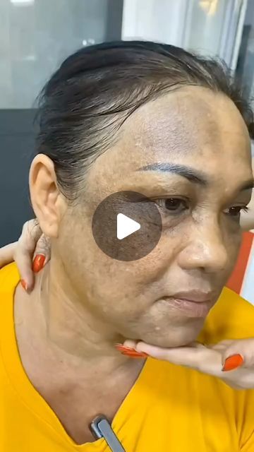 Get Rid Of Pigmentation On Face, How To Get Rid Of Black Spots On Face, Face Black Spot Removal, How To Get Rid Of Pigmentation On Face, Face Mask For Pigmentation, Pigmentation On Face, Pigmentation Remedy, Black Spots On Face, Face Glow